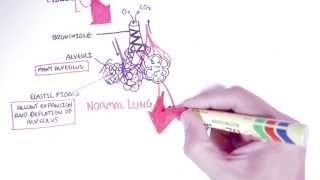 Emphysema  Introduction Types Symptoms Diagnosis [upl. by Beebe]