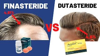 Dutasteride VS Finasteride  Which Is BETTER For Your Hair Growth [upl. by Lili920]