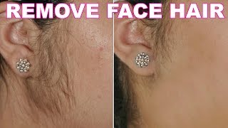 How To Remove Facial Hair Naturally  SkinCare Home Remedy  ShrutiArjunAnand [upl. by Retsim]