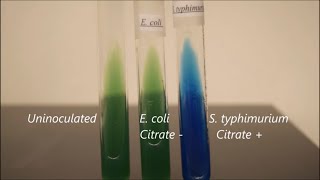 IMViC Timelapse Indole MRVP and Citrate [upl. by Gayle]