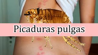 Urticaria en niños ¿cómo se produce ¿Tiene importancia [upl. by Anail]