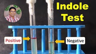 Bacterial Identification Tests Indole Test [upl. by Ynnep379]