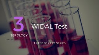 Widal test [upl. by Rab960]