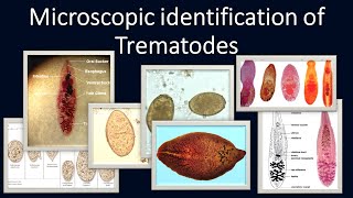 Microscopic identification of Trematodes [upl. by Aiak]