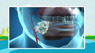 How Nicorette Works [upl. by Bohs]