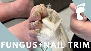 CRAZY THICK NAIL TRIM  FUNGUS [upl. by Terrene]