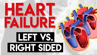 Left vs Right Heart Failure  Heart Failure Part 3 [upl. by Chiquita459]