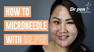 How to microneedle at home with Dr Pen  Dr Pen Australia  Microneedling  Skin Needling  CIT [upl. by Older]