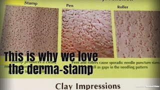 Dermapen Dermaroller DermaStamp HELP HELP [upl. by Orabel]