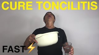 How to cure tonsillitis naturally [upl. by Margalo]