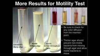 Microbiology Motility Test [upl. by Irtimd]