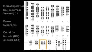 427 Analyze a human karyotype to determine gender and whether nondisjunction has occurred [upl. by Eemiaj629]