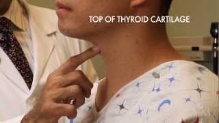 The Thyroid Exam Stanford Medicine 25 [upl. by Peers761]