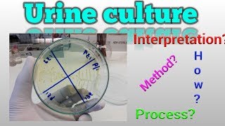 Urine culture test procedure Microbiology [upl. by Yme]