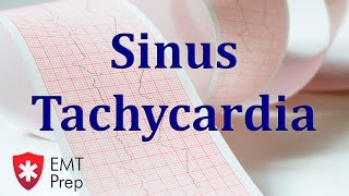 Normal Sinus Rhythm  EKG ECG Interpretation [upl. by Asseret]