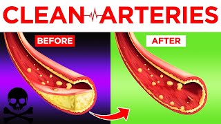 Supplements amp Herbs to Unclog Arteries Increase Oxygen  Dr Mandell [upl. by Ado135]