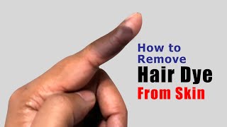 How to remove hair dye from skin  Easy amp Effective Method [upl. by Eeleak]