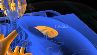 PET Scan animation [upl. by Elcin269]