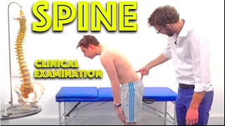 Spine Examination  Back Pain Assessment  4K  Clinical Skills  Dr Gill [upl. by Darrel]