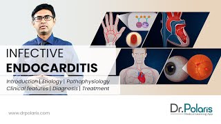 INFECTIVE ENDOCARDITIS  Etiology Pathophysiology Clinical Features Management  Animated [upl. by Brantley]