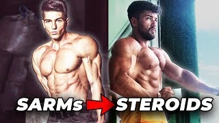 He Switched From SARMs To Steroids And This Is What Happened [upl. by Katusha845]