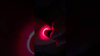 Illumivein Vein Finder In Use  Demonstration Video [upl. by Derby671]