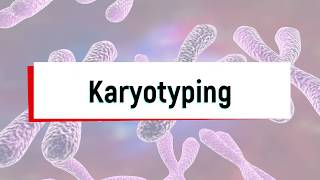 What is Karyotyping Test or Chromosomal Analysis [upl. by Yesnik]