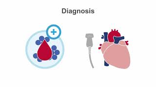 Endocarditis 101 Diagnosis and Treatment [upl. by Aliakim213]