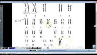 Karyotype analysis [upl. by Arob553]