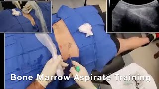 Bone Marrow Aspirate Training Highlight Reel [upl. by Easlehc86]