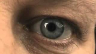 How to use the MGDRx EyeBag [upl. by Demeyer]