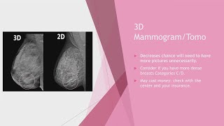 Breast MRI  common findings and cases [upl. by Sofer]