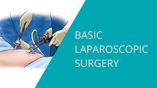 Basic Laparoscopic Surgery [upl. by Namhcan873]