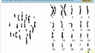 Make a Karyotype [upl. by Aynor]