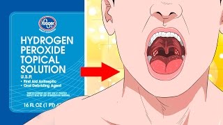 10 Surprising Uses For Hydrogen Peroxide YOU NEED TO KNOW [upl. by Nawat]