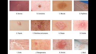 Skin Lesions with defination [upl. by Satsoc340]