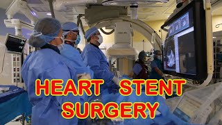 Heart Stent Surgery [upl. by Mohorva990]