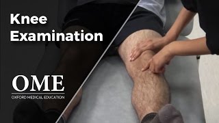 Knee Examination  Orthopaedics [upl. by Geof31]