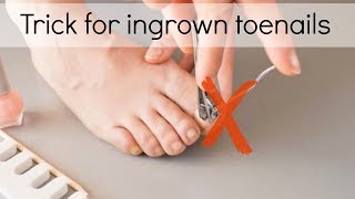 How to Fix Ingrown Toenails Easily [upl. by Llemrej]