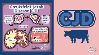 Creutzfeldt Jakob Disease CJD [upl. by Jorge]