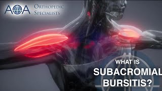 AOA Orthopedic Specialists  Subacromial Bursitis [upl. by Rebel435]