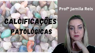 Calcificações patológicas [upl. by Flieger]