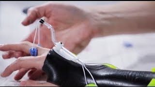 Dorsal wrist orthosis Orfilight Black with Orfitube outrigger  Splinting techniques 810 [upl. by Engle452]