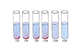 Widal test [upl. by Pardner]